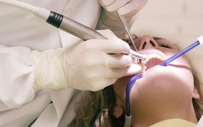 Sistemas de aspiración dental: todo lo que debes saber