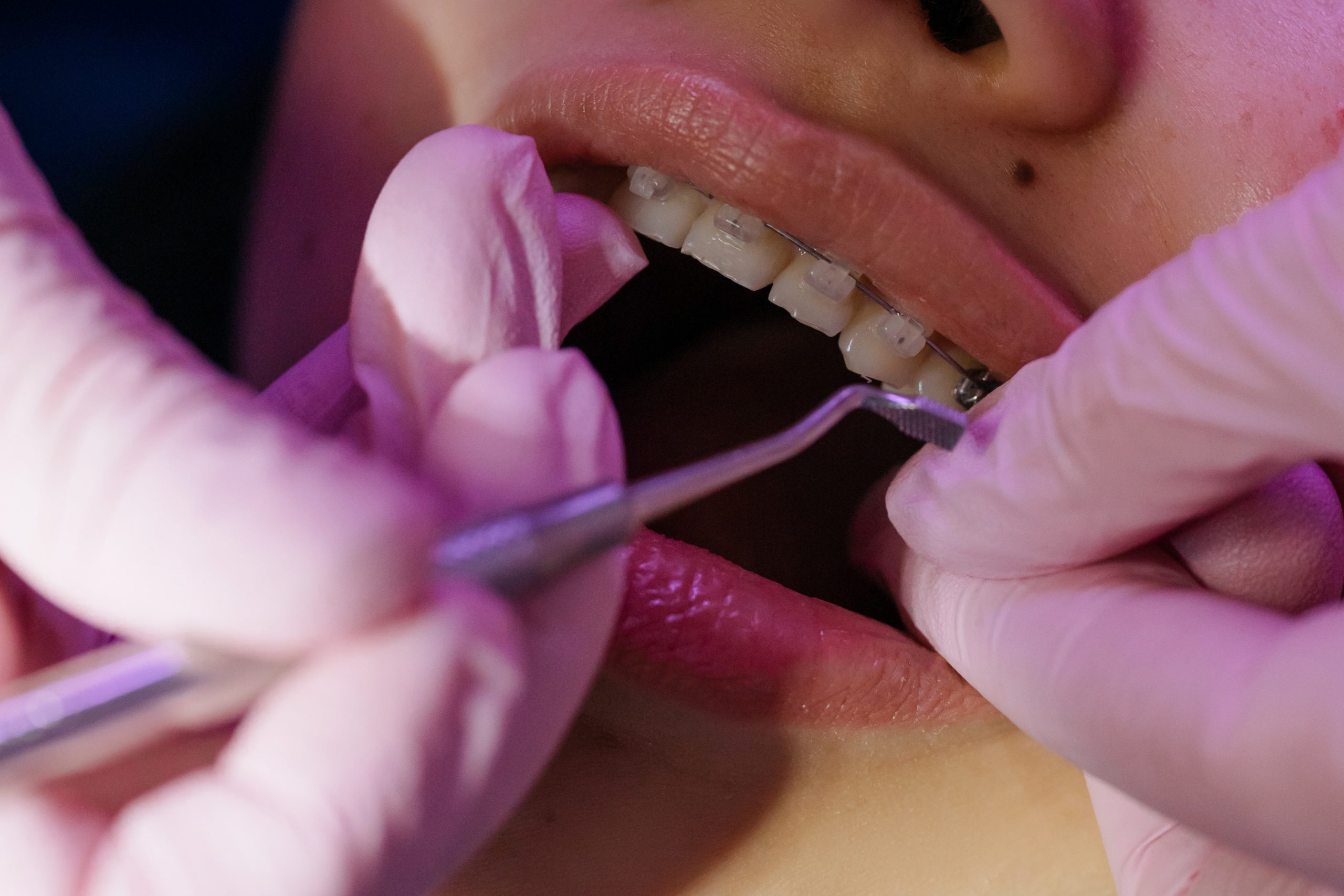 ¿Cuáles son los beneficios de la ortodoncia?