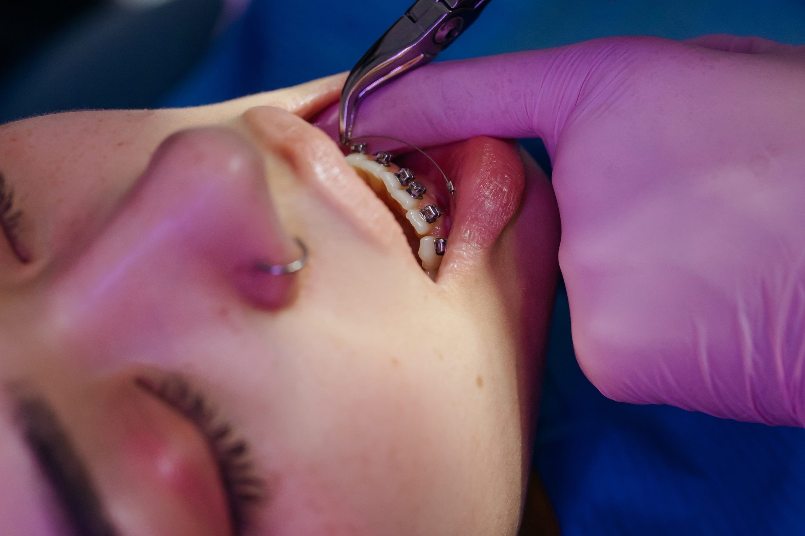 ventajas de la ortodoncia