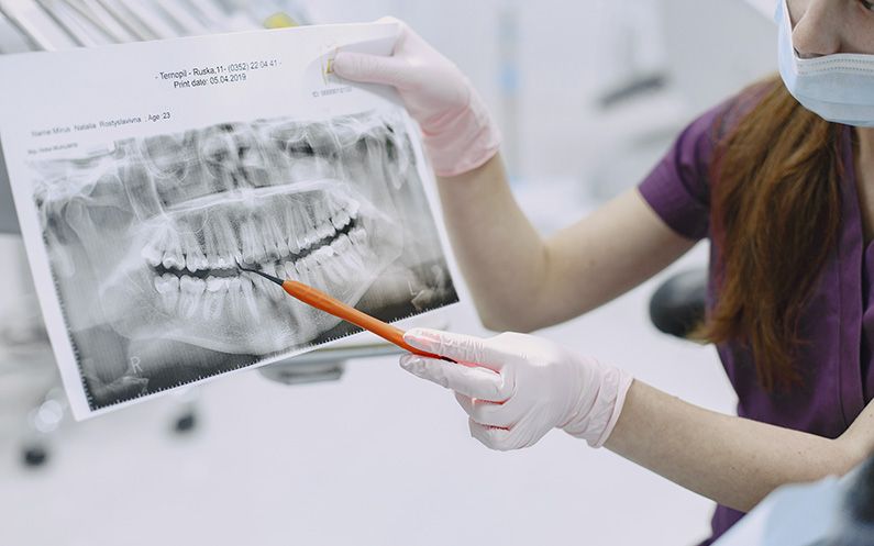 radiografías-dentales-riesgos
