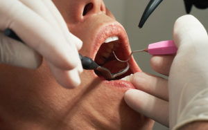 enfermedad-periodontal-