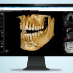 radiologia-digital-clinica-dental