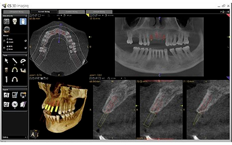 radiografía-panoramica-dental