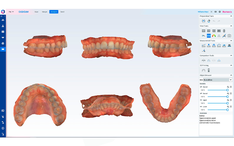equipo-radiologia-dental-software
